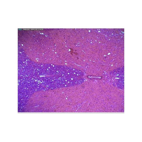 Spinal Cord T.S. (H.4-14)-(ELS-BB1278)